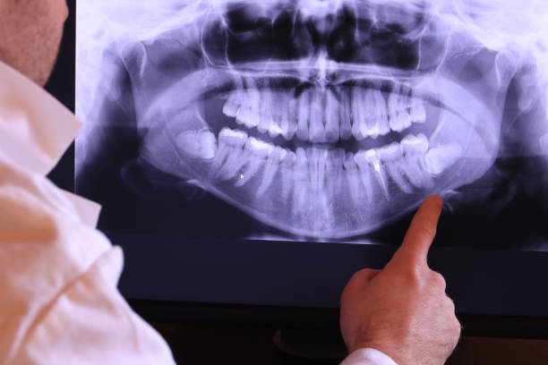 Best Pediatric Emergency Dentist in Cullowhee, NC