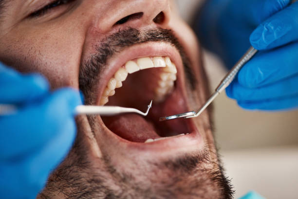 Best Urgent Dental Care for Toothache in Cullowhee, NC