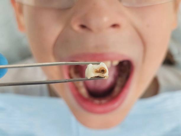 Best Orthodontic Emergency Dentist in Cullowhee, NC