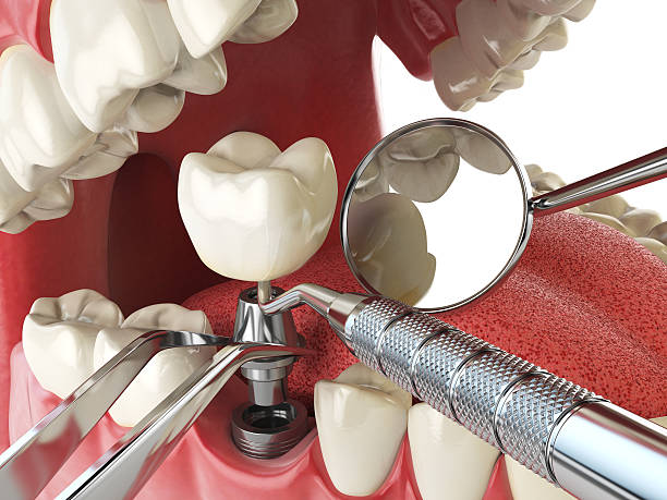 Best Broken or Cracked Tooth Emergency Dentist in Cullowhee, NC